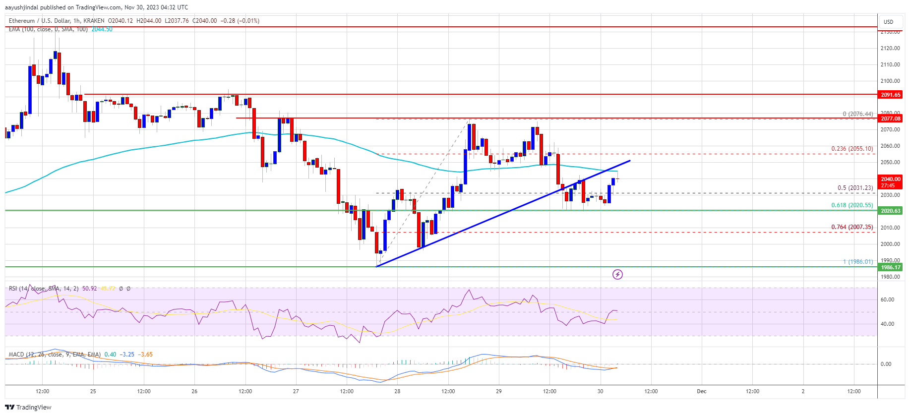 Ethereum Price Rally In Jeopardy? Key Supports To Watch Out In Short-Term Ethereum Price Rally In Jeopardy? Key Supports To Watch Out In Short-Term